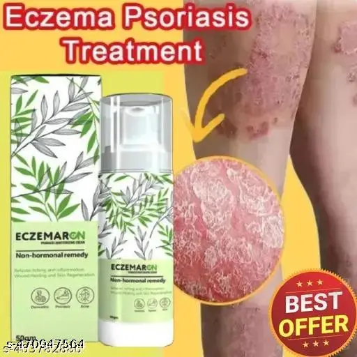 Eczemaron for Ringworm, itching, Eczema & Fungal Infection Anti Fungal Cream | (pack of 1)
